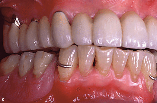 precision-dental-and-implant-Centre