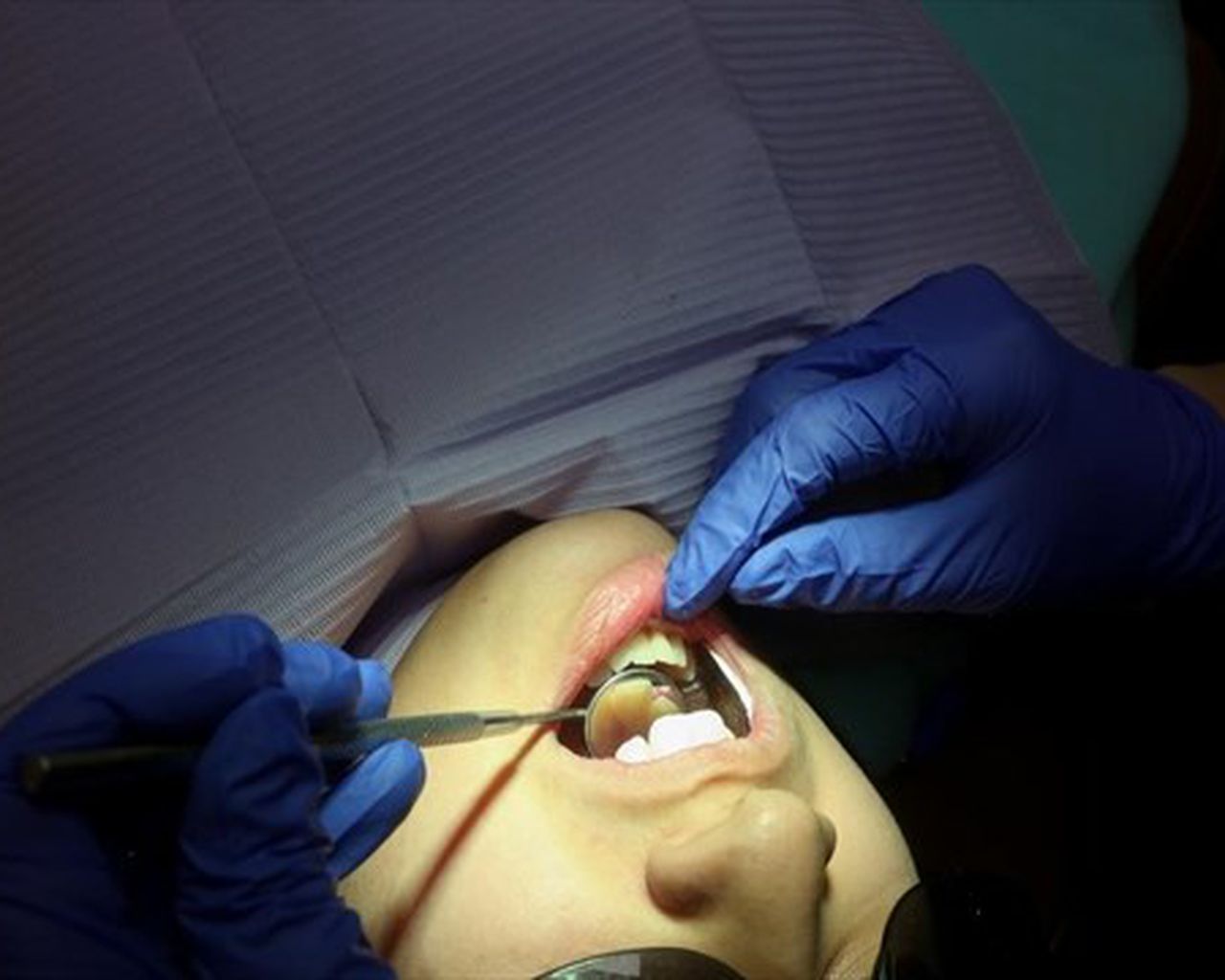 precision-dental-and-implant-Centre