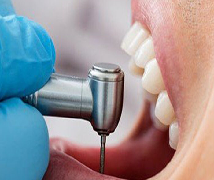 Restorative dentistry for tooth repair and function