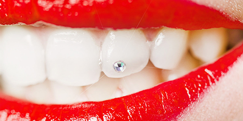 precision-dental-and-implant-Centre-48