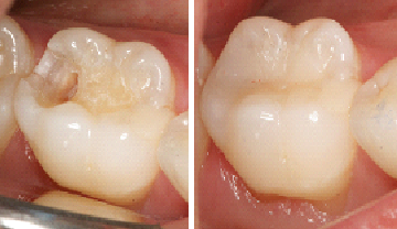 precision-dental-and-implant-Centre-22