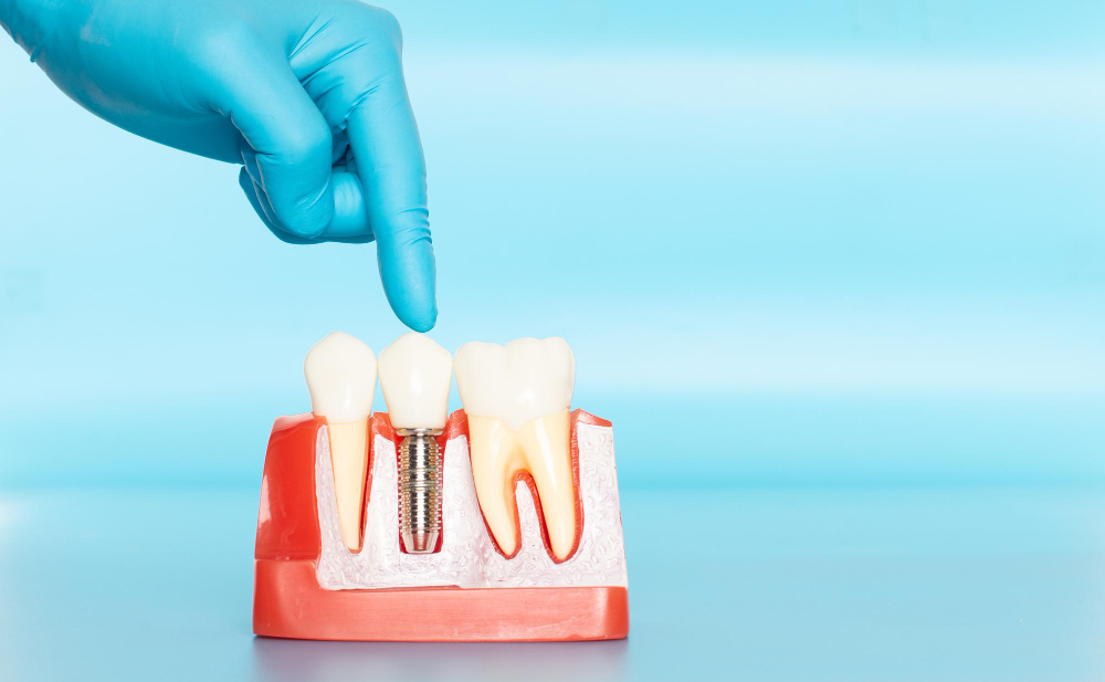 Root Canal Treatment in Kolkata | Best RCT Doctor