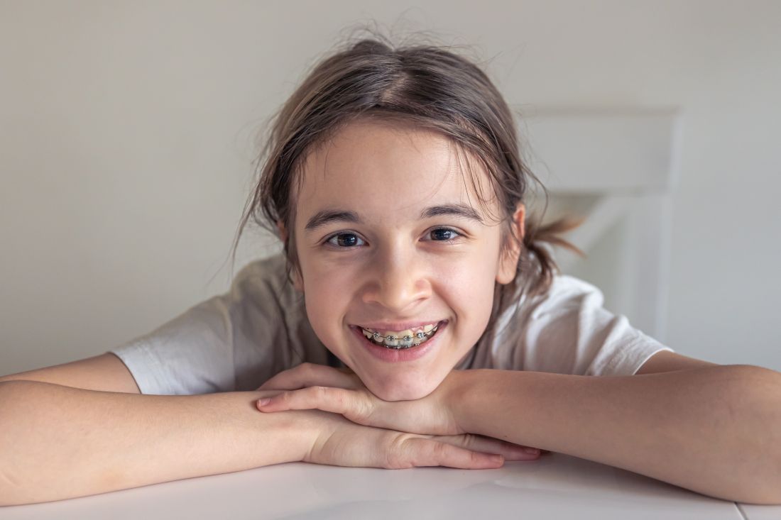 A smiling child with braces on their teeth, representing the importance of early orthodontic treatment for crooked teeth in kids