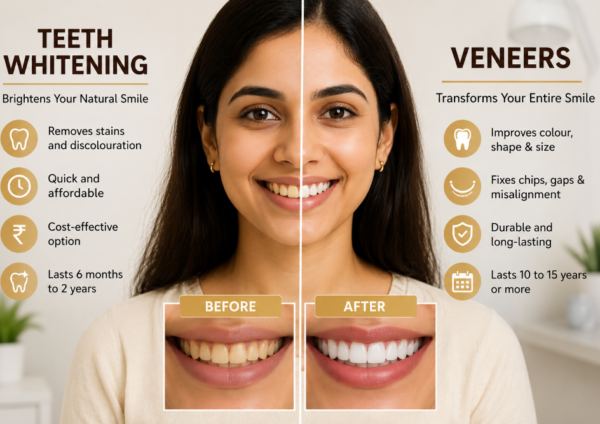 Indian woman smiling in a dental comparison graphic showing teeth whitening and veneers for improving smile colour, shape, and appearance.