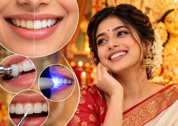 Smile makeover before Durga Puja showing teeth whitening, cleaning, bonding, and a festive smile